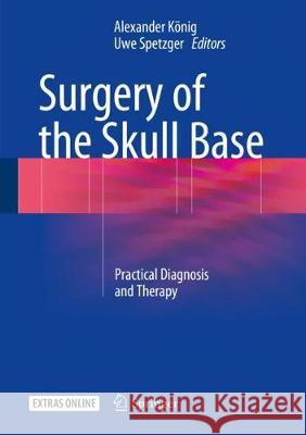 Surgery of the Skull Base: Practical Diagnosis and Therapy König, Alexander 9783319640174 Springer - książka