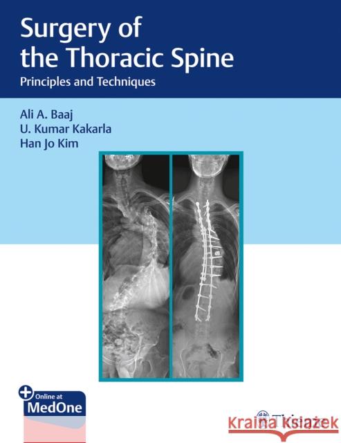 Surgery of the Thoracic Spine: Principles and Techniques Baaj, Ali A. 9781626238558 Thieme Medical Publishers - książka