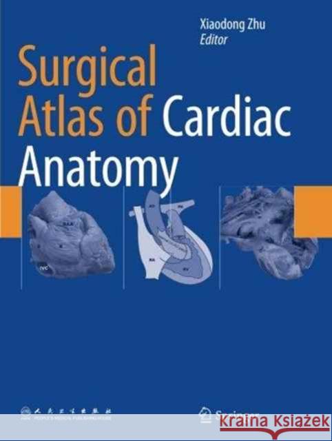 Surgical Atlas of Cardiac Anatomy Xiaodong Zhu 9789402402407 Springer - książka