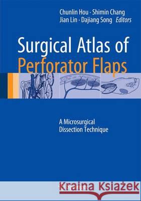 Surgical Atlas of Perforator Flaps: A Microsurgical Dissection Technique Hou, Chunlin 9789401798334 Springer - książka