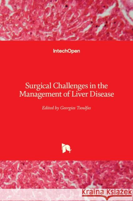 Surgical Challenges in the Management of Liver Disease Georgios Tsoulfas 9781838801571 Intechopen - książka