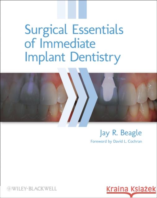 Surgical Essentials of Immediate Implant Dentistry Beagle, Jay R. 9780813816067 John Wiley & Sons - książka