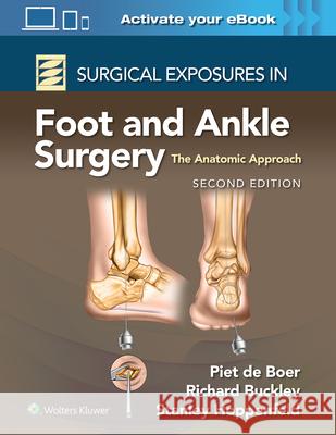 Surgical Exposures in Foot and Ankle Surgery: The Anatomic Approach Dr. Richard, MD Buckley 9781975192051 Wolters Kluwer Health - książka