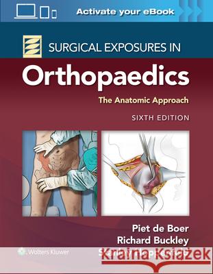 Surgical Exposures in Orthopaedics: The Anatomic Approach Dr. Piet de Boer, MD Richard Buckley, MD, FRCSC Stanley Hoppenfeld 9781975168797 Wolters Kluwer Health - książka