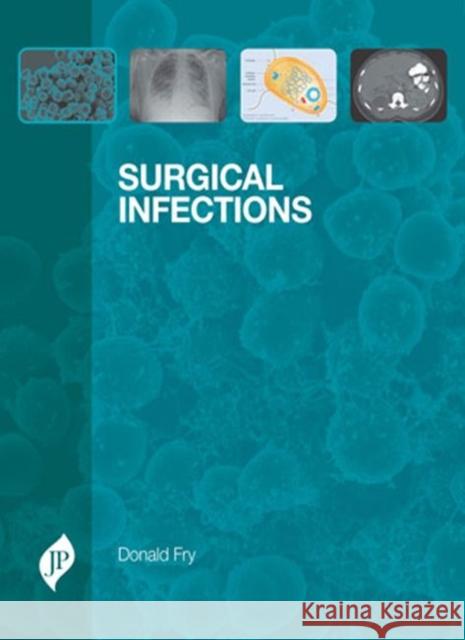 Surgical Infections Donald Fry   9781907816260 JP Medical Ltd - książka