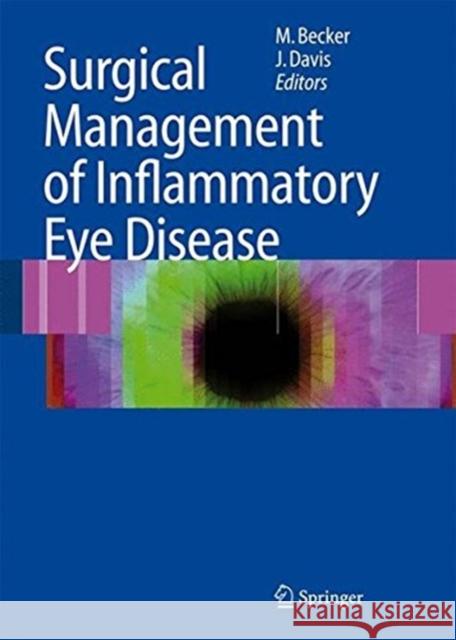 Surgical Management of Inflammatory Eye Disease Matthias D. Becker Janet Davis 9783662500934 Springer - książka