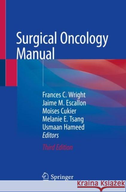 Surgical Oncology Manual  9783030483623 Springer - książka