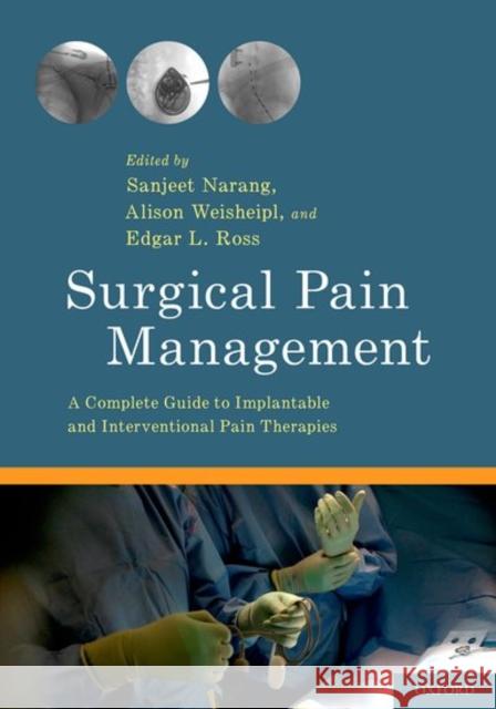 Surgical Pain Management: A Complete Guide to Implantable and Interventional Pain Therapies Sanjeet Narang Edgar L. Ross Alison Weisheipl 9780199377374 Oxford University Press, USA - książka