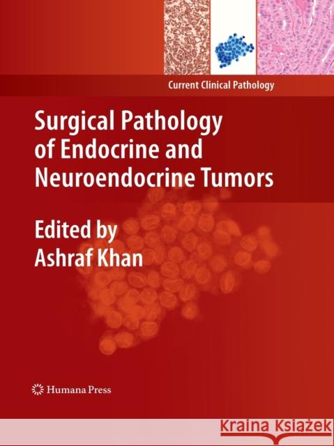 Surgical Pathology of Endocrine and Neuroendocrine Tumors Ashraf Khan 9781493961153 Humana Press - książka