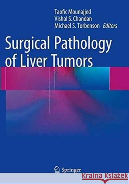 Surgical Pathology of Liver Tumors Taofic Mounajjed Vishal S. Chandan Michael S. Torbenson 9783319371559 Springer - książka