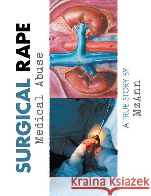 Surgical Rape: Medical Abuse Mzann 9781546239246 Authorhouse - książka