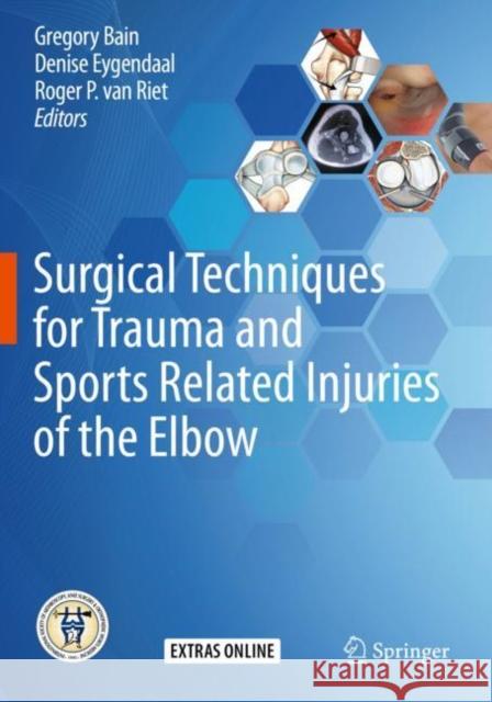 Surgical Techniques for Trauma and Sports Related Injuries of the Elbow Gregory Bain Denise Eygendaal Roger P. Va 9783662589335 Springer - książka