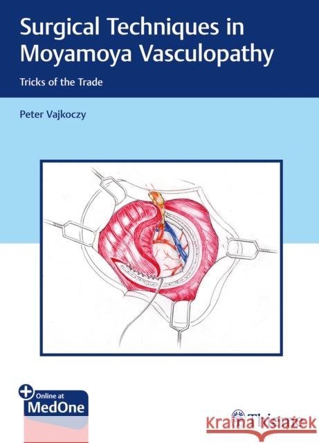 Surgical Techniques in Moyamoya Vasculopathy: Tricks of the Trade Vajkoczy, Peter 9783131450616 Thieme Medical Publishers - książka