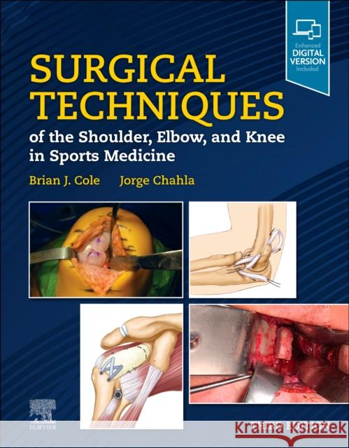 Surgical Techniques of the Shoulder, Elbow, and Knee in Sports Medicine Brian J. Cole Jorge Chahla 9780323763004 Elsevier - książka