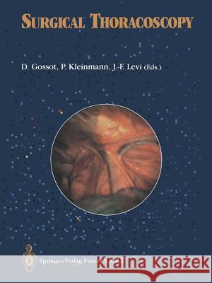 Surgical Thoracoscopy Gossot, D. 9782817808963 Springer - książka