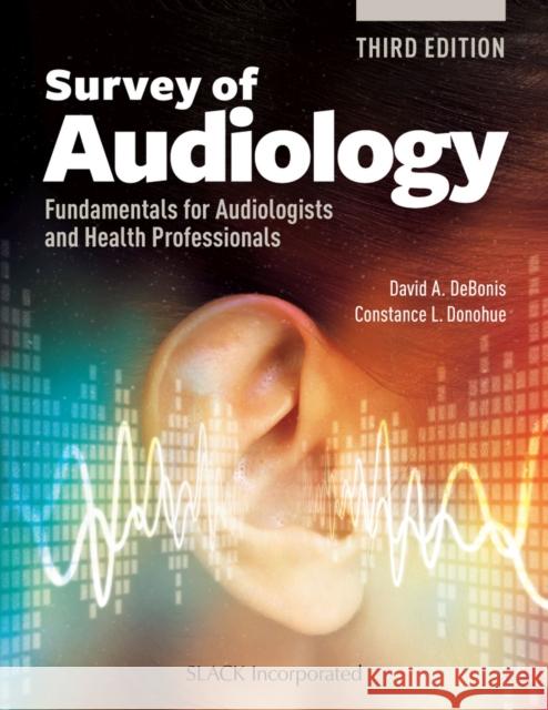 Survey of Audiology: Fundamentals for Audiologists and Health Professionals, Third Edition David A. Debonis Constance L. Donohue 9781630915032 Slack - książka