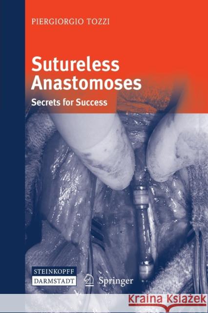 Sutureless Anastomoses: Secrets for Success Tozzi, Piergiorgio 9783662526866 Steinkopff - książka