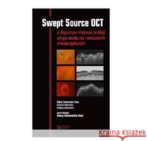 Swept Source OCT Romanowska-Dixon Bożena Jakubowska Barbara Karska-Basta Izabella 9788361257196 Górnicki - książka