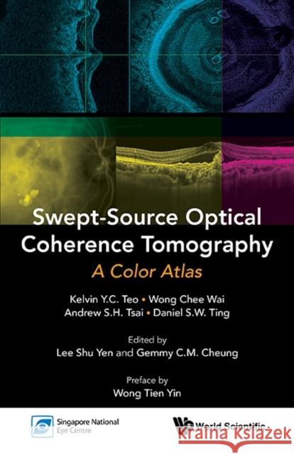 Swept-Source Optical Coherence Tomography: A Color Atlas Kelvin Y. C. Teo Chee Wai Wong Andrew S. H. Tsai 9789814704212 World Scientific Publishing Co Pte Ltd - książka