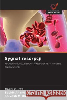 Sygnal resorpcji Gupta, Rashi, Arora, Sachit Anand, Mishra, Shivesh 9786208499747 Wydawnictwo Nasza Wiedza - książka