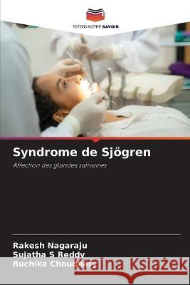 Syndrome de Sj?gren Rakesh Nagaraju Sujatha S. Reddy Ruchika Choudhary 9786205860519 Editions Notre Savoir - książka