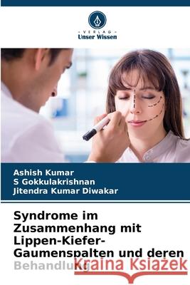 Syndrome im Zusammenhang mit Lippen-Kiefer-Gaumenspalten und deren Behandlung Kumar, Ashish, Gokkulakrishnan, S, Diwakar, Jitendra Kumar 9786202334921 Verlag Unser Wissen - książka