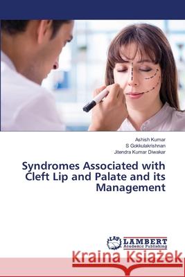 Syndromes Associated with Cleft Lip and Palate and its Management Kumar, Ashish, Gokkulakrishnan, S, Diwakar, Jitendra Kumar 9786208447922 LAP Lambert Academic Publishing - książka