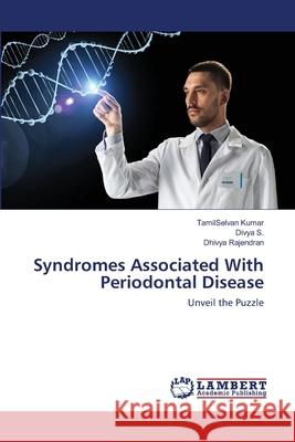 Syndromes Associated With Periodontal Disease Kumar, Tamilselvan 9786202511728 LAP Lambert Academic Publishing - książka