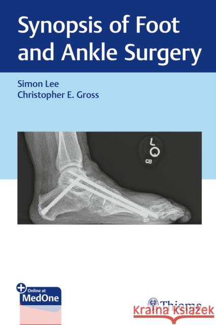 Synopsis of Foot and Ankle Surgery Simon Lee Christopher Gross 9781626237247 Thieme Medical Publishers - książka