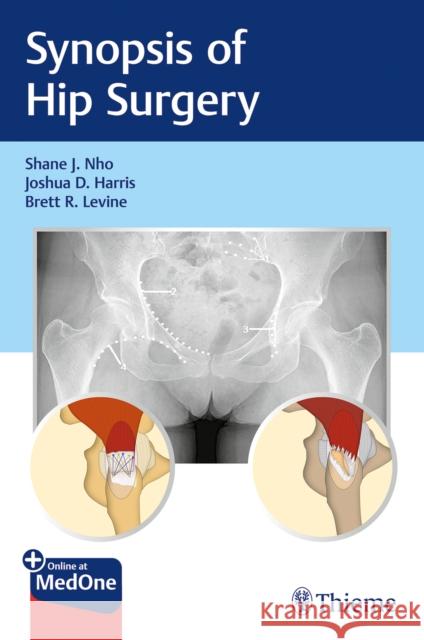 Synopsis of Hip Surgery Nho, Shane J. 9781626235243 Thieme Medical Publishers - książka