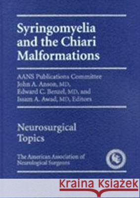 Syringomyelia and the Chiari Malformations  9783131324917 American Association of Neurological Surgeons - książka