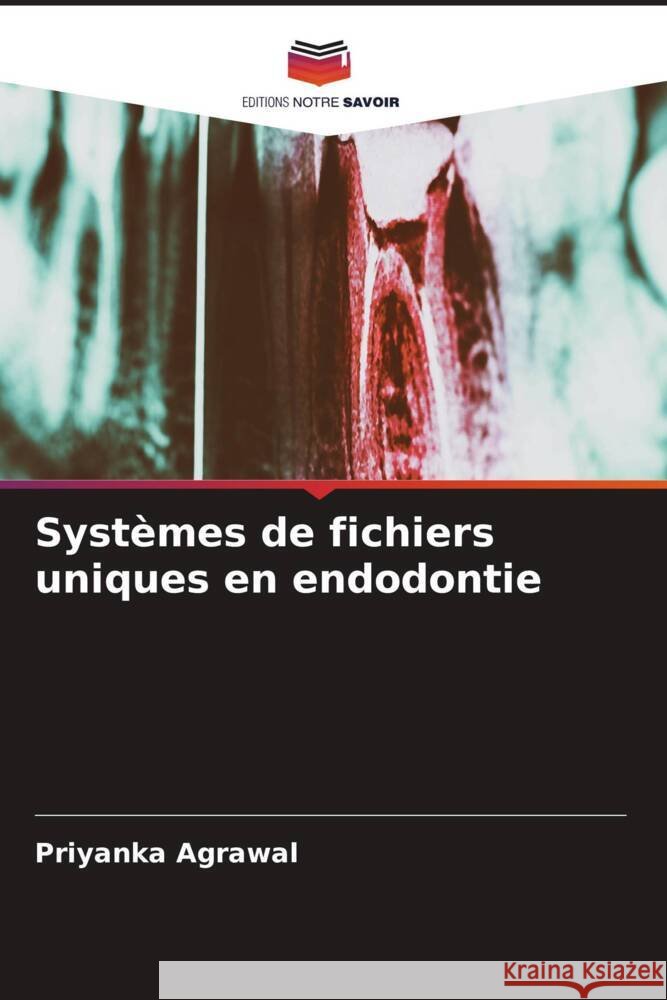 Systèmes de fichiers uniques en endodontie Agrawal, Priyanka 9786204903545 Editions Notre Savoir - książka