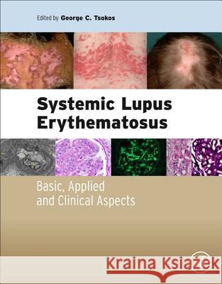 Systemic Lupus Erythematosus: Basic, Applied and Clinical Aspects Tsokos, George   9780128019177 Elsevier Science - książka