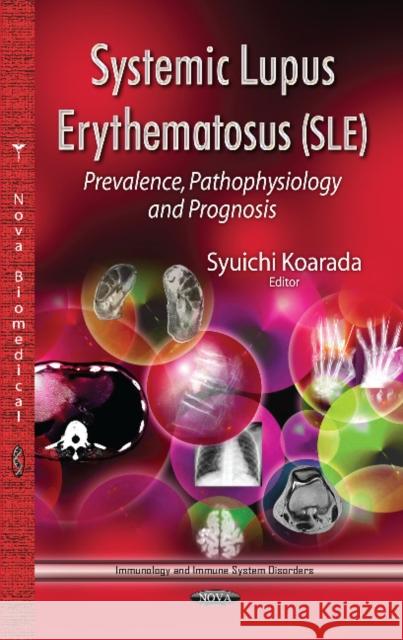 Systemic Lupus Erythematosus (SLE): Prevalence, Pathophysiology & Prognosis Syuichi Koarada 9781628089905 Nova Science Publishers Inc - książka