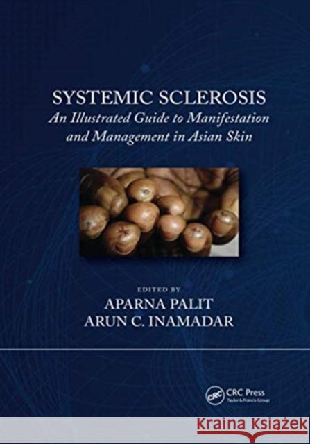 Systemic Sclerosis: An Illustrated Guide to Manifestation and Management in Asian Skin Arun C. Inamadar Aparna Palit 9780367731403 CRC Press - książka