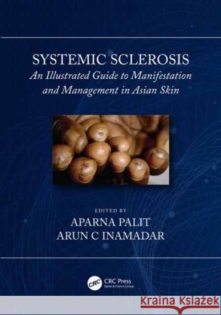 Systemic Sclerosis: An Illustrated Guide to Manifestation and Management in Asian Skin Arun C. Inamadar Aparna Palit 9781138480049 CRC Press - książka