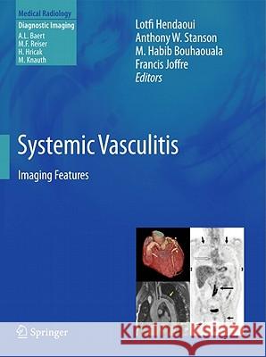 Systemic Vasculitis: Imaging Features Hendaoui, Lotfi 9783642024832 Springer - książka