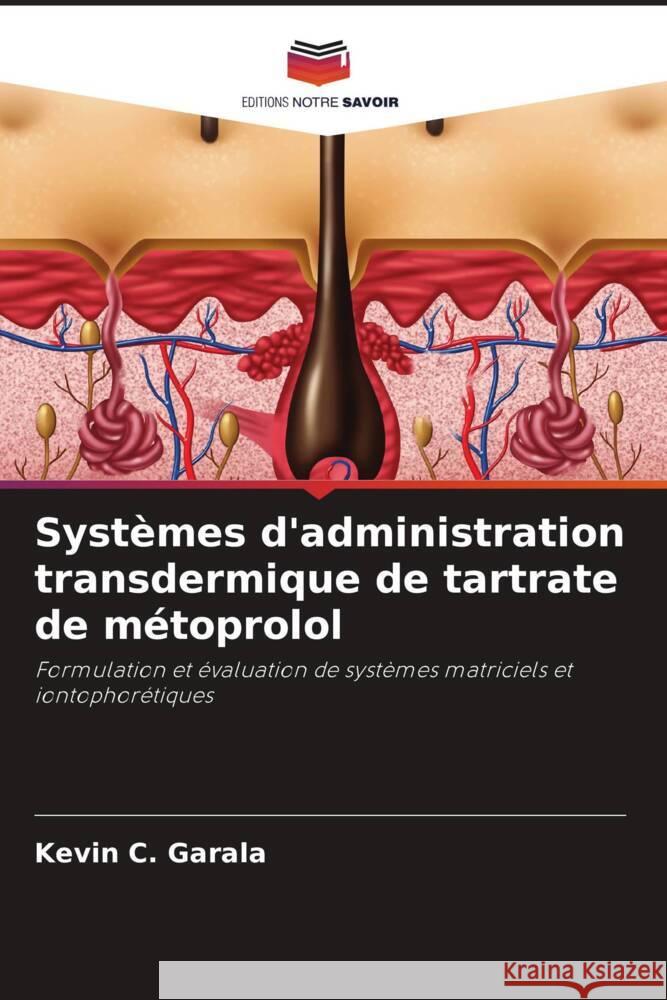 Systèmes d'administration transdermique de tartrate de métoprolol Garala, Kevin C. 9786208309213 Editions Notre Savoir - książka