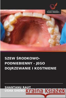 SZEW SRODKOWO-PODNIEBIENNY - JEGO DOJRZEWANIE I KOSTNIENIE RAUT, SHANTANU, Shenoy, Usha 9786202334563 Wydawnictwo Nasza Wiedza - książka