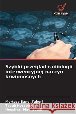 Szybki przegląd radiologii interwencyjnej naczyń krwionośnych Morteza Sanei Taheri Tayeb Hosseini Houshyar Maghsoudi 9786208703790 Wydawnictwo Nasza Wiedza - książka
