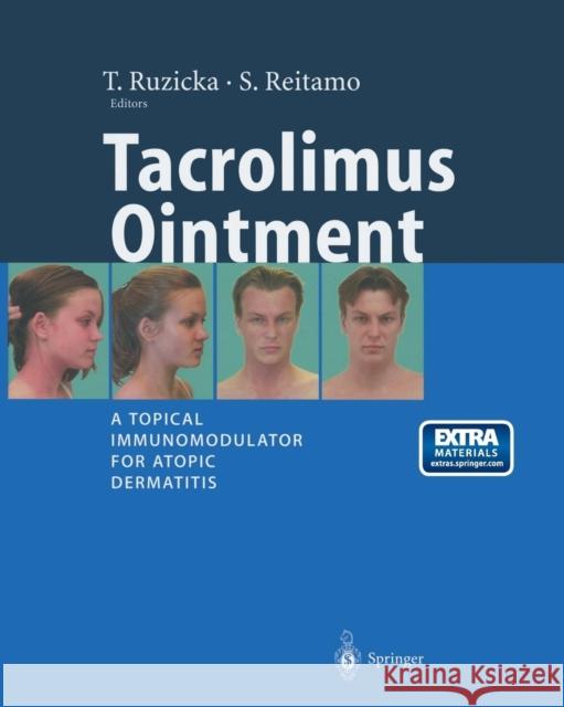 Tacrolimus Ointment: A Topical Immunomodulator for Atopic Dermatitis Ruzicka, T. 9783662102114 Springer - książka