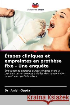 Étapes cliniques et empreintes en prothèse fixe - Une enquête Dr Anish Gupta 9786203284911 Editions Notre Savoir - książka