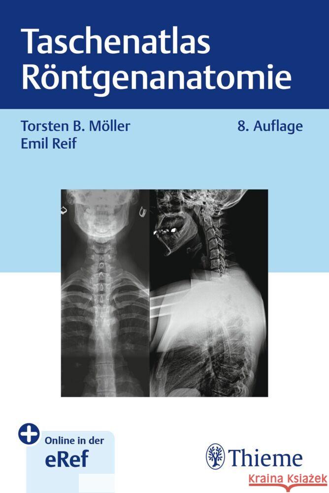 Taschenatlas Röntgenanatomie Möller, Torsten Bert, Reif, Emil 9783132460072 Thieme, Stuttgart - książka