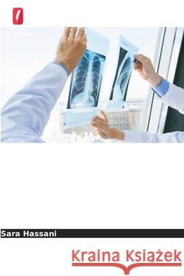 Taxas de recorrência do cancro após cirurgia conservadora da mama Hassani, Sara 9786209317248 Edições Nosso Conhecimento - książka