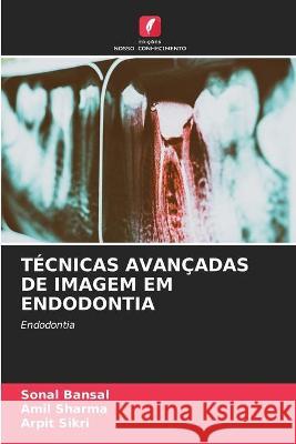 Técnicas Avançadas de Imagem Em Endodontia Sonal Bansal, Amil Sharma, Arpit Sikri 9786204175775 Edicoes Nosso Conhecimento - książka