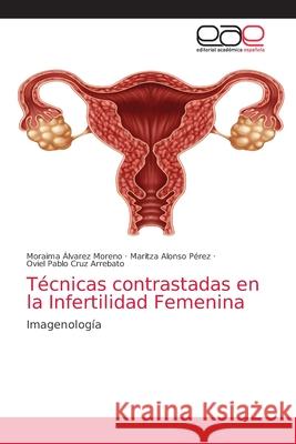 Técnicas contrastadas en la Infertilidad Femenina Moraima Álvarez Moreno, Maritza Alonso Pérez, Oviel Pablo Cruz Arrebato 9786203585810 Editorial Academica Espanola - książka