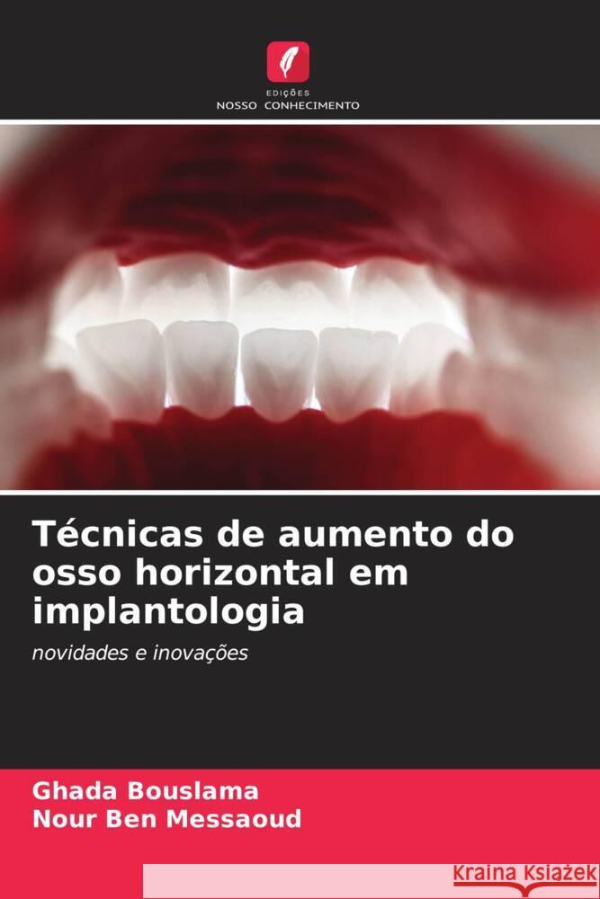 Técnicas de aumento do osso horizontal em implantologia Bouslama, Ghada, Ben Messaoud, Nour 9786208253622 Edições Nosso Conhecimento - książka