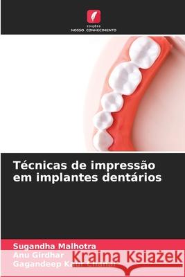 Técnicas de impressão em implantes dentários Malhotra, Sugandha, Girdhar, ANU, Chahal, Gagandeep kaur 9783841639929 Edições Nosso Conhecimento - książka