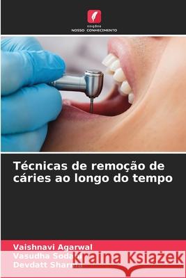 T?cnicas de remo??o de c?ries ao longo do tempo Vaishnavi Agarwal Vasudha Sodani Devdatt Sharma 9786207529278 Edicoes Nosso Conhecimento - książka