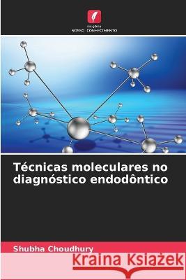 T?cnicas moleculares no diagn?stico endod?ntico Shubha Choudhury 9786205693155 Edicoes Nosso Conhecimento - książka